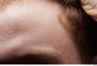 HD Face Skin Fergal face forehead hair skin pores skin…